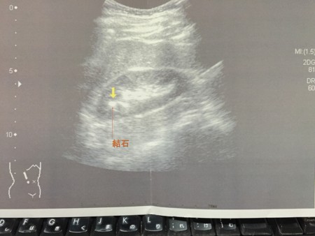 f:id:yumejitsugen1:20141225103420j:plain f:id:yumejitsugen1:20141225103420j:plain