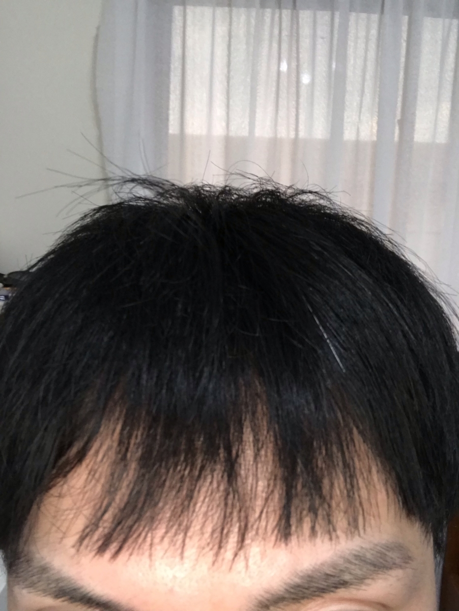 f:id:A28_K:20200921192930j:plain f:id:A28_K:20200921192930j:plain