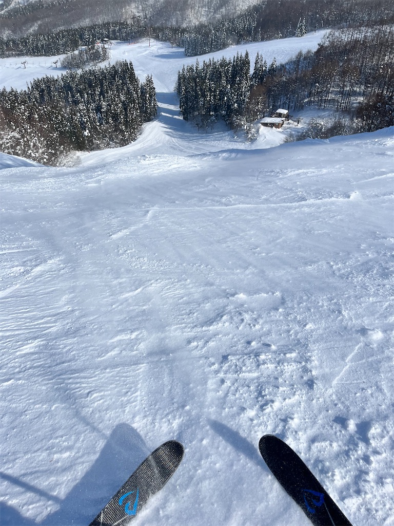 f:id:ABi-R:20220215194618j:image f:id:ABi-R:20220215194618j:image