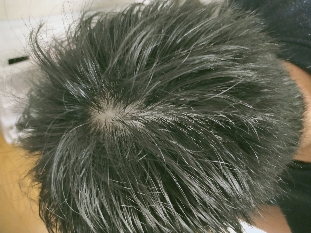 f:id:AIASUTA:20211023220922j:plain