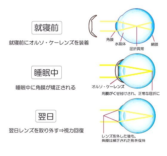 f:id:AR30:20070622171934j:plain