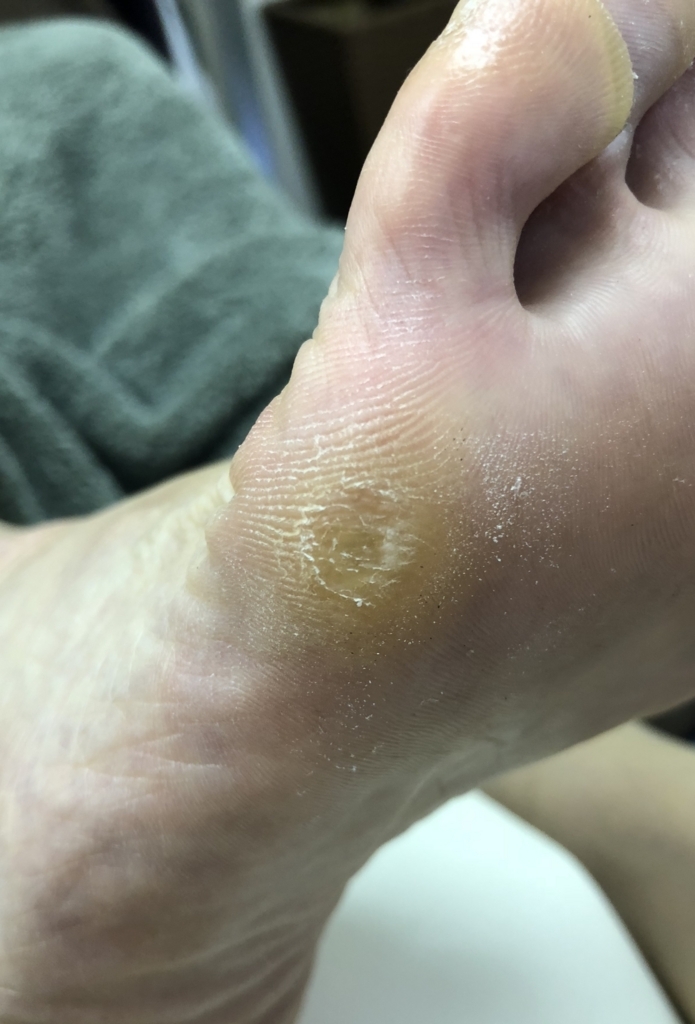 f:id:ASHIMARUKUN:20180602141801j:plain