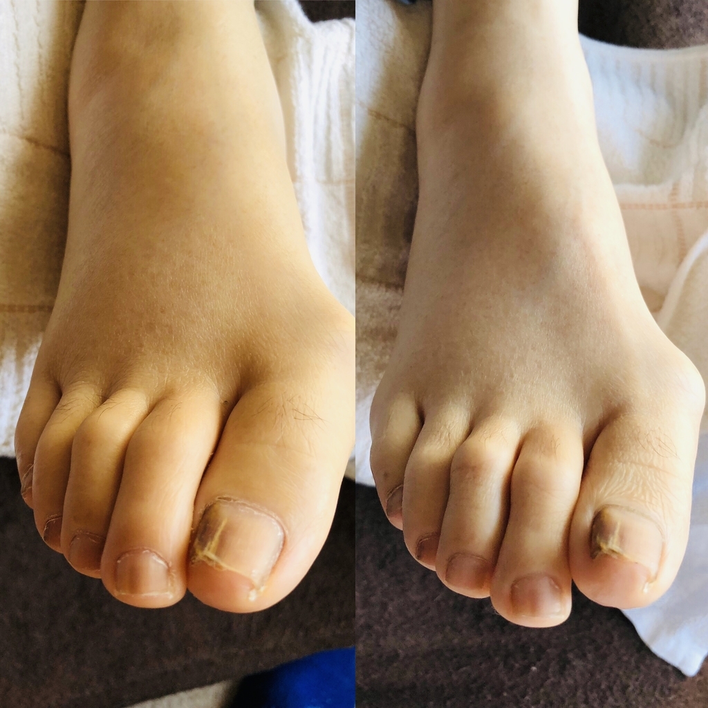 f:id:ASHIMARUKUN:20190204142436j:plain
