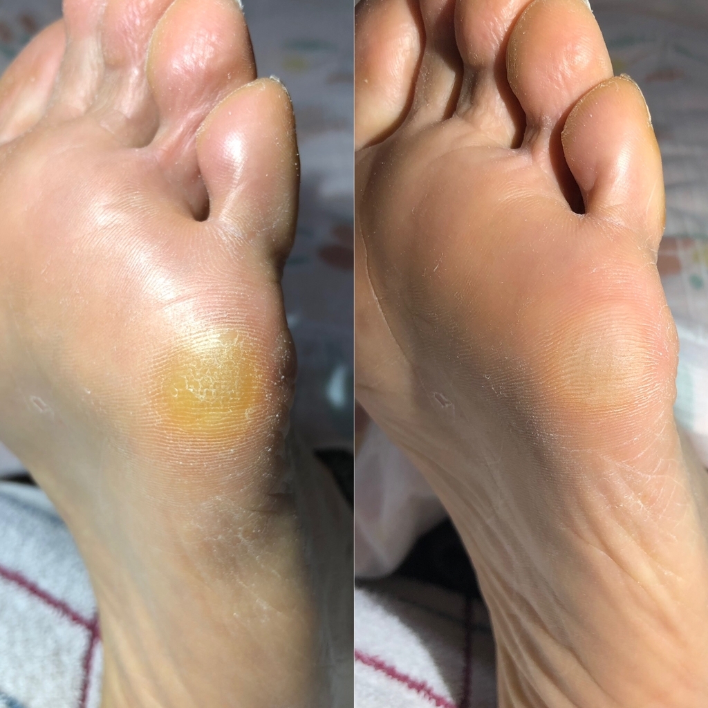 f:id:ASHIMARUKUN:20190207162402j:plain
