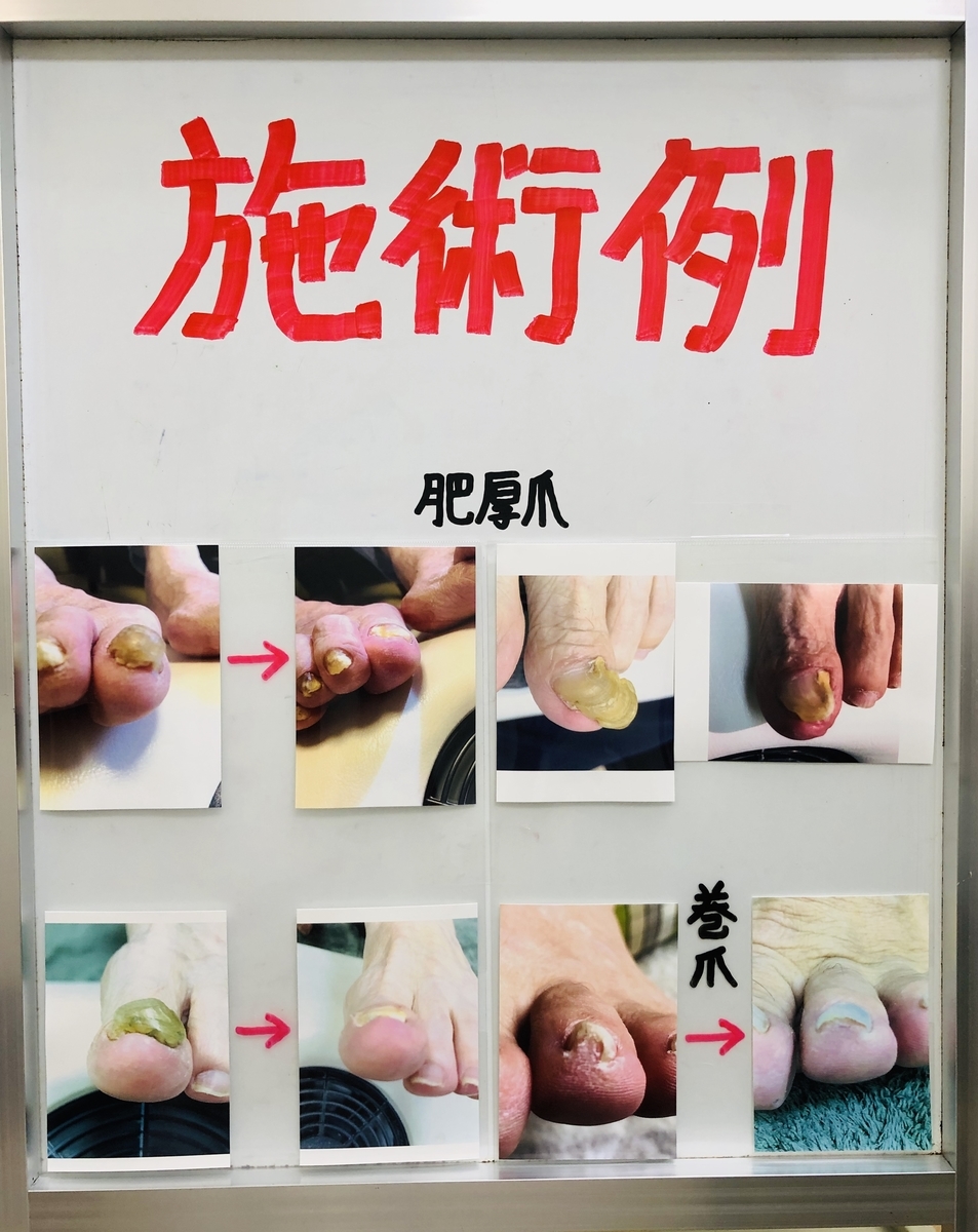 f:id:ASHIMARUKUN:20190727171158j:plain