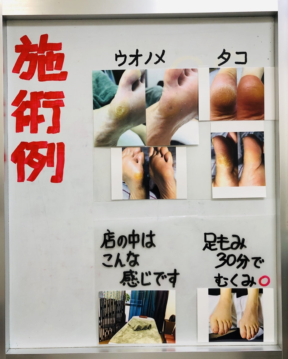 f:id:ASHIMARUKUN:20190727171224j:plain