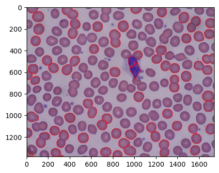 "Watershedによる輪郭抽出結果"