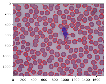 "閾値変更後のWatershedによる輪郭抽出結果"