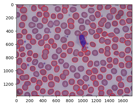 "閾値0.5でのWatershedによる輪郭抽出結果"
