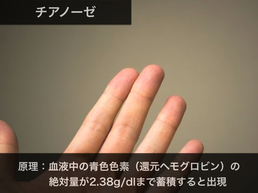 Act フィジカルアセスメントー復習会ー 定期勉強会16 12 13 Action