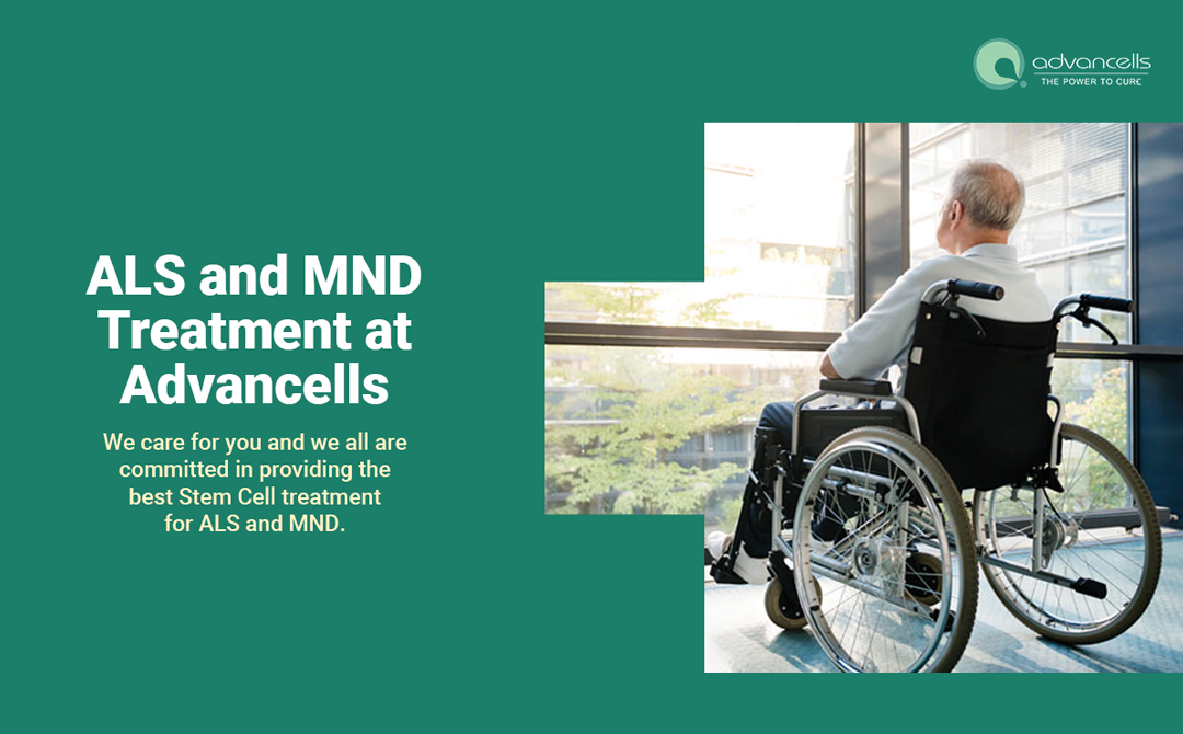 treatments for MND