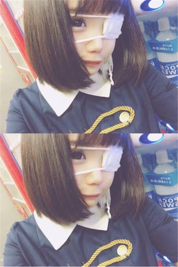 f:id:Alprazolaminc:20201003005817j:image