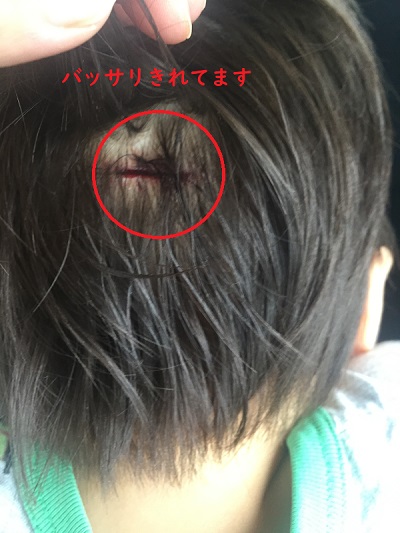 f:id:Alstroemeria:20190708230232j:plain