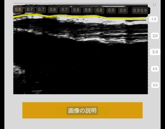 f:id:Androtest:20230614210832j:image