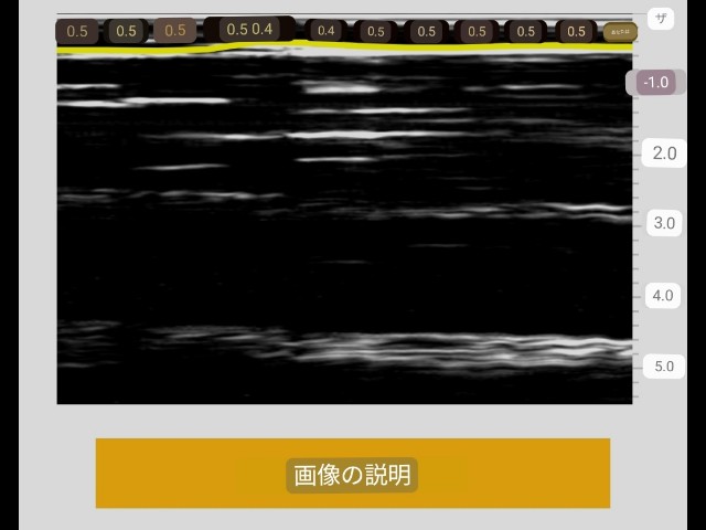 f:id:Androtest:20230614210929j:image