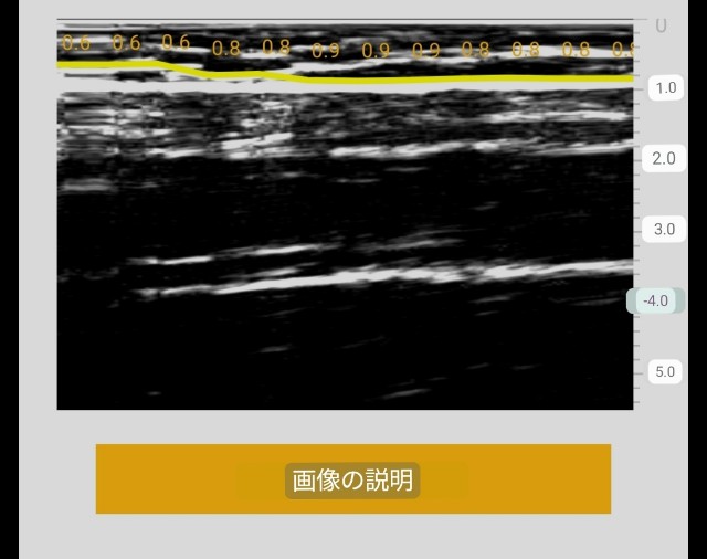 f:id:Androtest:20230614211004j:image