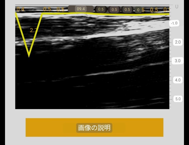 f:id:Androtest:20230614211030j:image