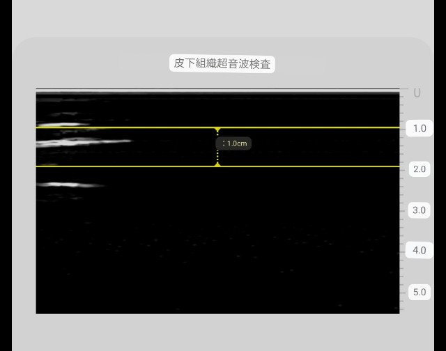f:id:Androtest:20230614211054j:image