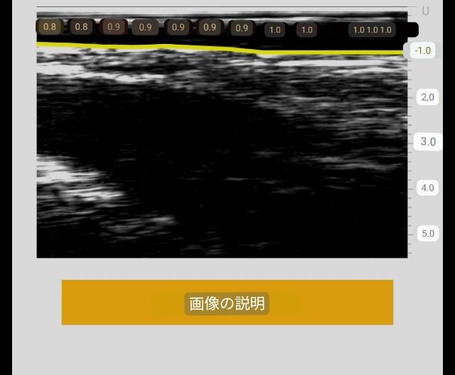 f:id:Androtest:20230615213010j:image