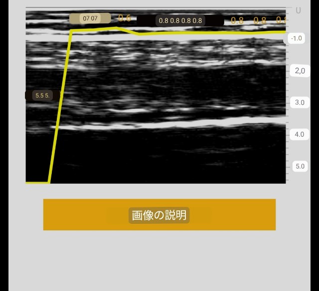 f:id:Androtest:20230615213148j:image