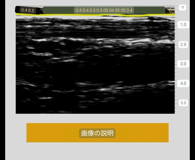 f:id:Androtest:20230615213217j:image