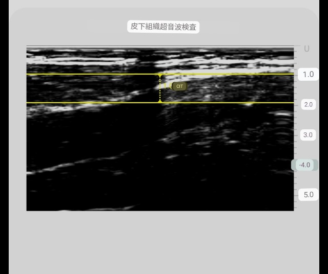 f:id:Androtest:20230615213409j:image