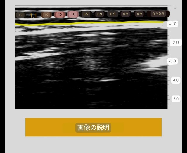 f:id:Androtest:20230618090430j:image
