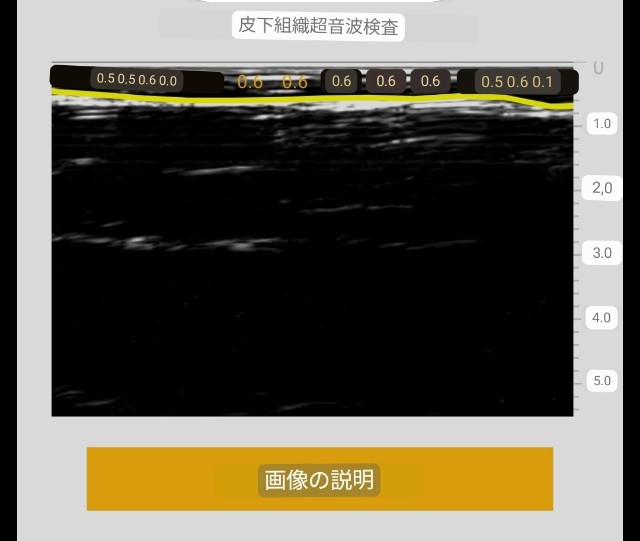 f:id:Androtest:20230618090516j:image