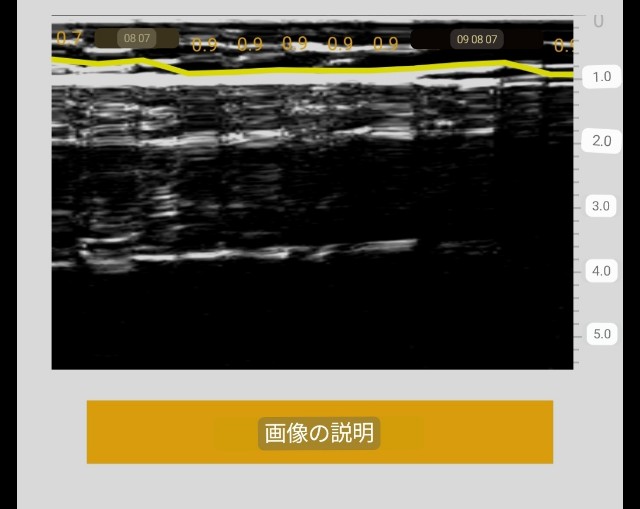 f:id:Androtest:20230618090555j:image