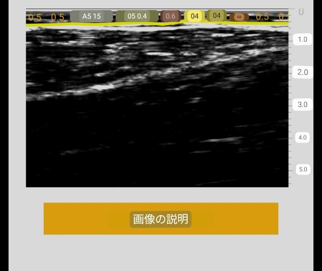 f:id:Androtest:20230618090620j:image