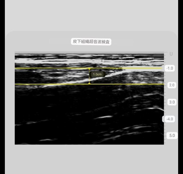f:id:Androtest:20230618090804j:image