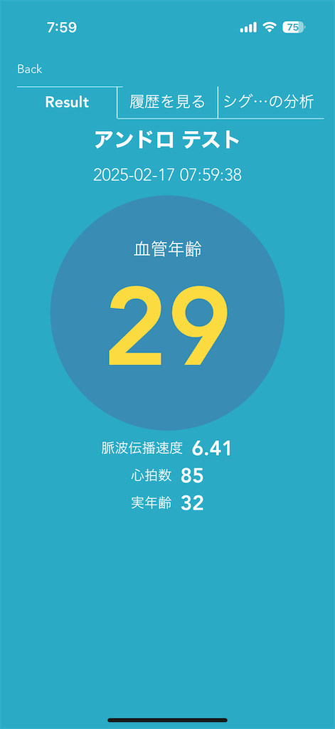 自己観察日記 126日目 - 宇宙船自転車号船長の航行日誌