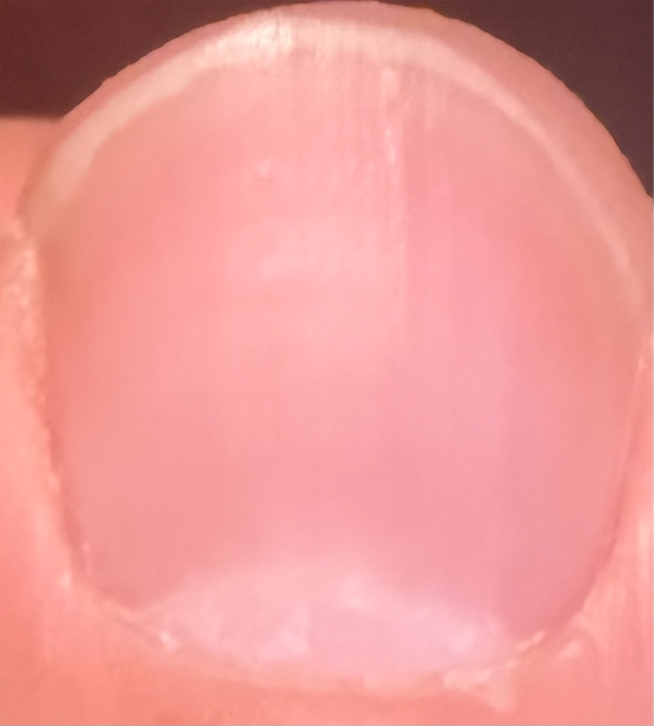 f:id:Androtest:20260107064254j:image f:id:Androtest:20260107064254j:image