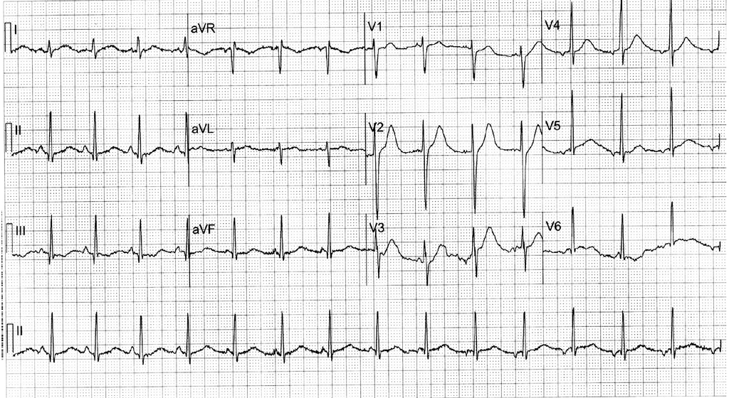 f:id:AppleQQ:20190201053628p:plain f:id:AppleQQ:20190201053628p:plain