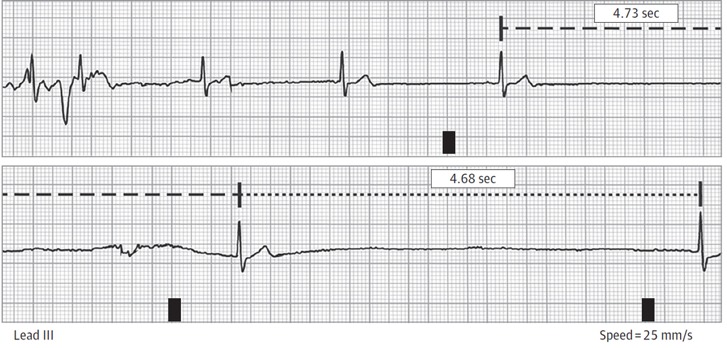 f:id:AppleQQ:20190305075738p:plain f:id:AppleQQ:20190305075738p:plain
