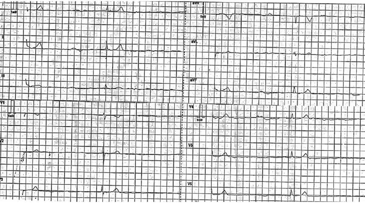 f:id:AppleQQ:20190614084016p:plain f:id:AppleQQ:20190614084016p:plain