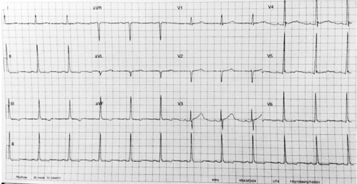 f:id:AppleQQ:20190614084317p:plain f:id:AppleQQ:20190614084317p:plain