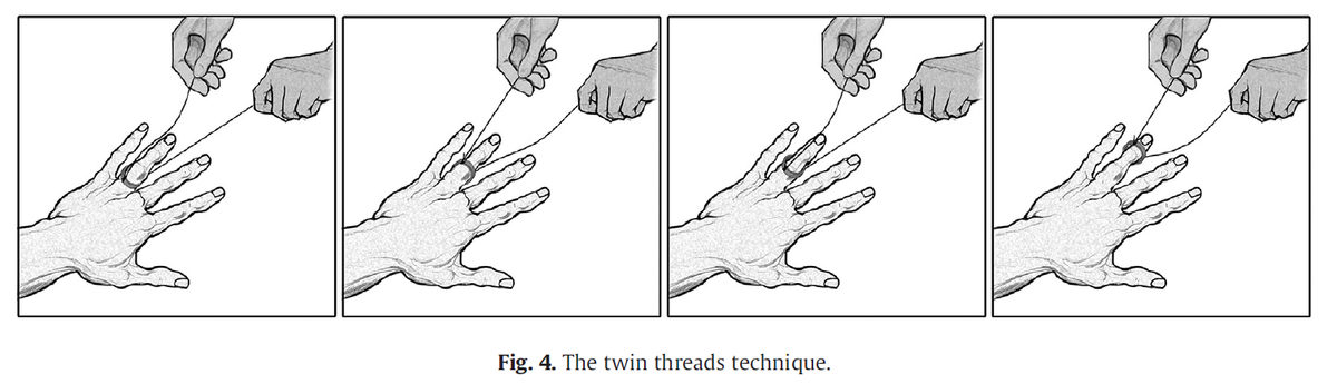 f:id:AppleQQ:20190904175404p:plain f:id:AppleQQ:20190904175404p:plain