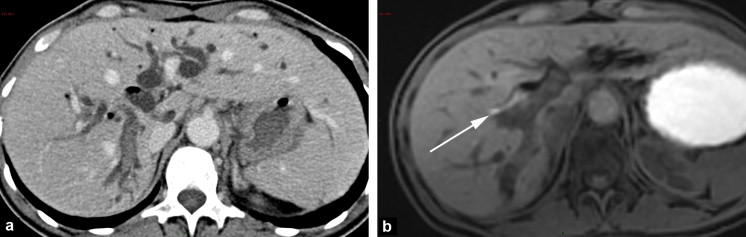 f:id:AppleQQ:20200504162309p:plain f:id:AppleQQ:20200504162309p:plain