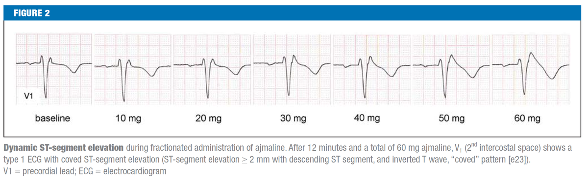f:id:AppleQQ:20201208204531p:plain