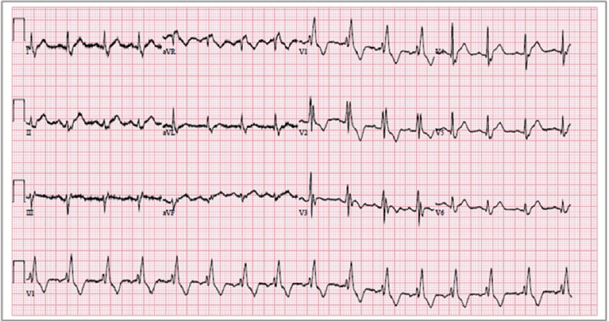 f:id:AppleQQ:20201210233423p:plain