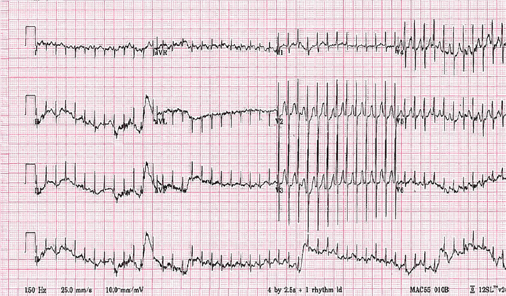 f:id:AppleQQ:20201214095122p:plain