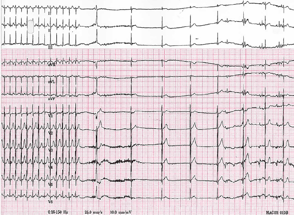 f:id:AppleQQ:20201214113213p:plain