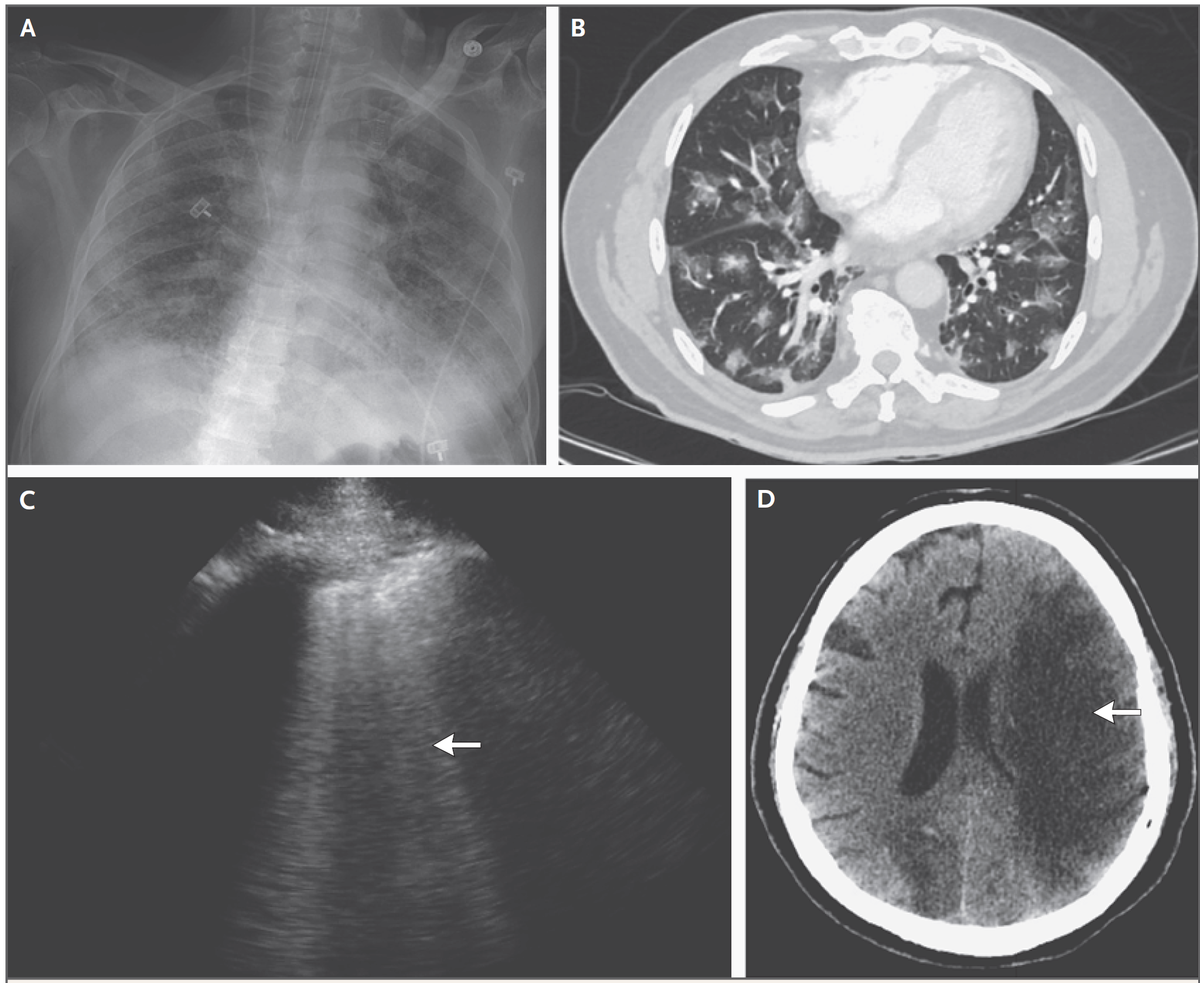 f:id:AppleQQ:20201217230449p:plain