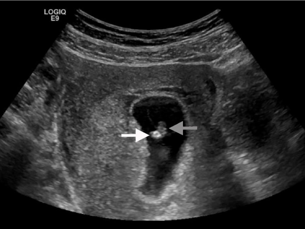 f:id:AppleQQ:20201224195631p:plain