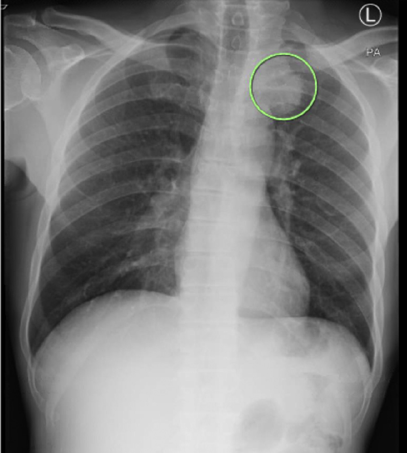 f:id:AppleQQ:20210102080218p:plain