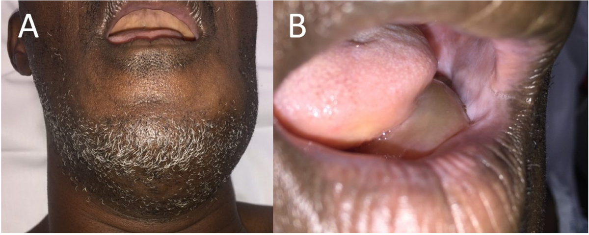 f:id:AppleQQ:20210106154307p:plain