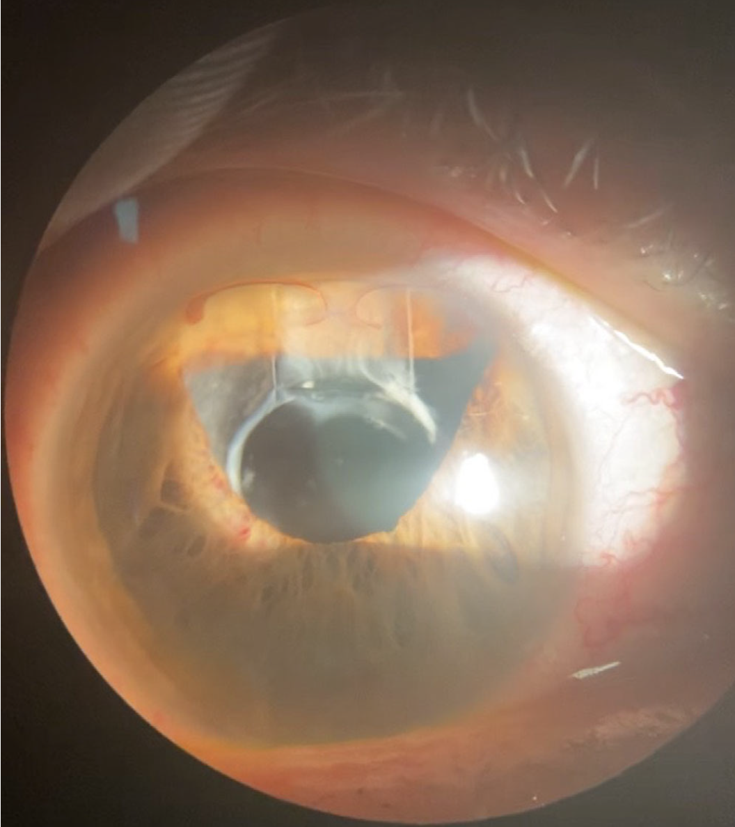 f:id:AppleQQ:20210120221823p:plain