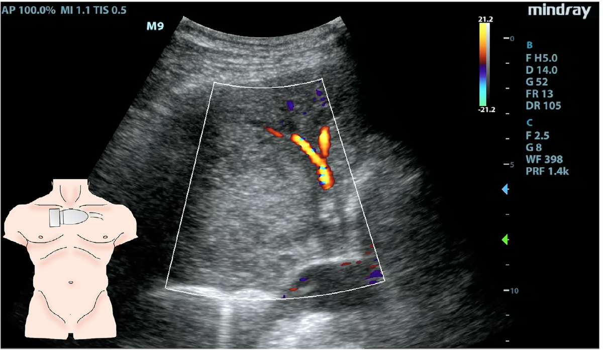 f:id:AppleQQ:20210129174842p:plain