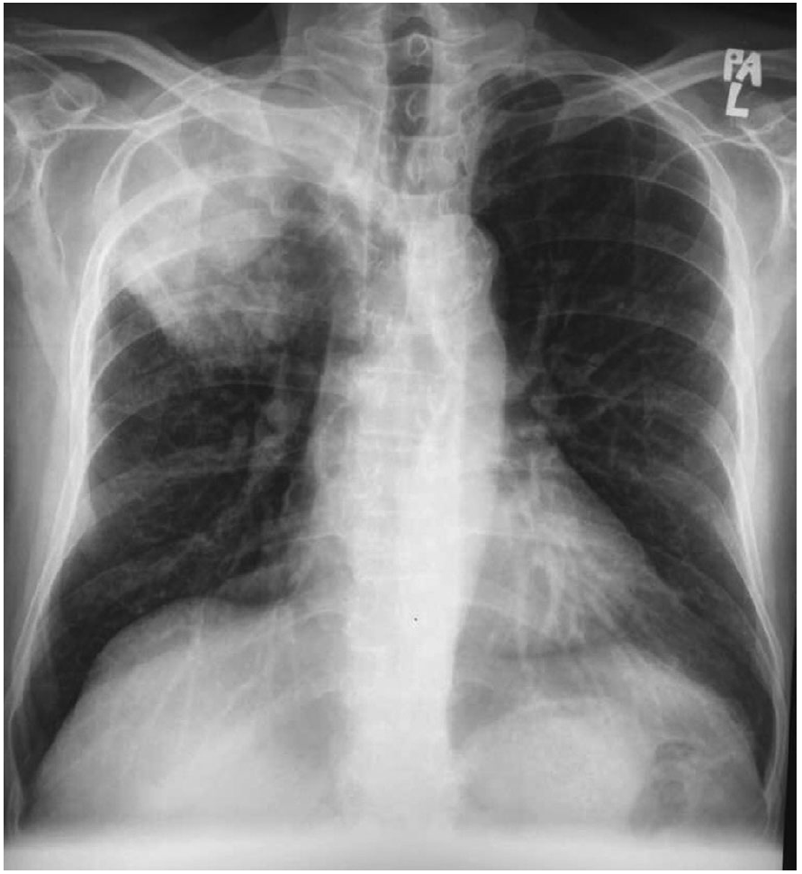 f:id:AppleQQ:20210129174922p:plain